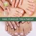 Antifungal Nail Treatment for Damaged Nails - Toe Care Solution for Renewing Discolored Feet - Buy Online on GoSupps.com