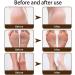 Winter Cracked Skin Repair Cream Hand Foot Cream Moisturising Cream Portable For Adults Kids Foot Care Cream Foot & Heel Moisturising Balm For Rough Dry And Chapped Hands Feet - Buy Online on GoSupps.com