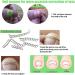 Braleto Toenail Clippers Set Manicure Tools Set for Thick Nails Stainless Steel Toenail Cutters Nail File Ingrown nail pliers Gel Big Toe Cap toenail corrector strips for Ingrown Toenail Treatment - Buy Online on GoSupps.com