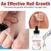 2023 La Nouvelle Huile de soulagement Rapide de l'onychomycose favorise Une Croissance des Ongles Plus Saine et Plus Forte 4pcs - Buy Online on GoSupps.com