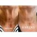 Skinremide 2 Silicon Chest Wrinkle Pads - Anti Wrinkle Reusable Patches for Decollete - Overnight Treatment for Skin Lines Prevention - Buy Online on GoSupps.com