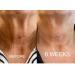Skin Remide 2 Silicone-Fold Pads | Anti-Wrinkle Treatment | Reusable Patches for Neck Line Smoothing - Buy Online on GoSupps.com
