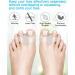 Golbylicc 8 Pairs Bunion Corrector Toe Separators - Gel Toe Spacers for Overlapping Toes - Men and Women (Clear) - Buy Online on GoSupps.com
