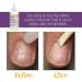 ProLinc Cuticle Eliminator - 4 fl oz - Buy Online on GoSupps.com