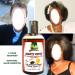 Fountain Mighty Roots - Hair Growth Remedy | Boar Brush Satin Cap & Spray Bottle | Stimulate Follicles for Healthier Hair - Buy Online on GoSupps.com