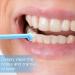 Wonyoing Soft Toothbrush Precise Cleaning for Wisdom Teeth & Implants | Small Head 48 Pack (Yellow Blue Pink Orange) - Ideal for Hard-to-Reach Areas - Buy Online on GoSupps.com