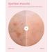 Glam Up Hydrocolloid Acne Patches (108 Counts) - Invisible Ultra Thin Spot Cover Absorbing Pimple Facial Stickers for Zit and Blemishes 2 Sizes 10mm & 12mm - Buy Online on GoSupps.com