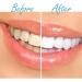 DentaPro Activated Bamboo Charcoal Teeth-Whitening Toothpaste - Mint Flavor | Natural & Effective Oral Care for a Bright Smile - Buy Online on GoSupps.com