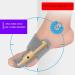 ENPAP Toe Separator Pads for Pain Relief and Toe Correction - Valgus, Hammer Toe, Big Joint - Splint Aid for Surgery Treatment - Buy Online on GoSupps.com