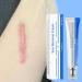 Scar Removal Fade Stretch Marks 30g Gel Reduces Stretch Marks Keloids Surgical Wounds Injuries Cesarean Section New and Old Scars - Buy Online on GoSupps.com