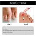 Ingrown Toenail Treatment Nail Helper Nail Growth Treatment Ingrowing Toenail Treatment Ingrown Toenail Correction Drops Ingrown Toenail Corrector Treatment for Ingrown Toenail Cuticle Oil - Buy Online on GoSupps.com