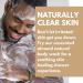 Almond Shower Gel (200ml) by Naturally Solved - Anti Fungal Body Wash for Jock Itch, Thrush, Acne & Athletes Foot - Buy Online on GoSupps.com