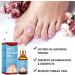Ingrown Toenail Treatment Ingrown Toenail Treatment Drop Toenail Anti Paronychia Relief Oil Fungal Nail Treatment for Toenails Ingrown Toenail Treatment Nail Growth Treatment Nail Care (30ML) - Buy Online on GoSupps.com