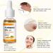 Horuili Turmeric Dark Spot Corrector Serum Turmeric Anti-Oxidant Serum for Skin Lightening Turmeric Essential Facial Oil Deep Moisturizing Face Cream (3pcs) - Buy Online on GoSupps.com