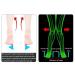 Hallux Valgus Silicone Arch Correction Inserts | Daily Foot Care | Elitzia ETFT020 - International Shipping Available - Buy Online on GoSupps.com