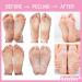 BabySkin Ultimate Foot Peeling Mask - Exfoliating Spa Scrub for Cracked Heels Dead Skin & Calluses - Shop Internationally - Buy Online on GoSupps.com