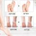 Electric Foot File Ruspela Electric Callus Remover for Feet Foot Callus Remover Rechargeable Foot Scrubber Foot File with 2 Heads 2 Speeds - Buy Online on GoSupps.com