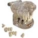 Buy DYTAH Transparent Teeth Model - Removable Pathological Tooth for Dental Training & Examination | International Shipping - Buy Online on GoSupps.com