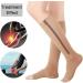 Buy Aynkh Extra Large 20-30 mmHg Compression Socks with Zipper | Knee High Open Toe Support Stockings for Varicose Veins Edema Swollen Legs & Pregnancy Relief - Buy Online on GoSupps.com