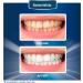 Professional Teeth Strips 7 Treatments - Enamel Safe - Non-Sensitive Formula - 14 Peroxide-Free Whitening Strips - Dentist Formulated Teeth Whitening Kit - Buy Online on GoSupps.com