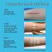 Longmed Emergency Wound Closures - Butterfly Adhesive Bandages - 3 Pieces - Buy Online on GoSupps.com