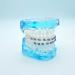 1 Pair of Temporary Tooth Decoration Teeth Retainer Practical Brackets para Dientes Sturdy Retenedores de Dientes Ortodoncia Props for Dental Students to Practice (Blue) - Buy Online on GoSupps.com