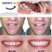 Zmoope Instant Veneers - 10 Pair Temporary Smile Cosmetics | Comfort Fit Dentures & Teeth Stickers for Perfect Smile - Buy Online on GoSupps.com