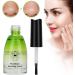 Blackhead Remover Anti-Acne Serum Blackhead Removal Deep Pore Blackhead Cleaning Liquid Tool for Face Skin Care & Purify Skin(11g) - Buy Online on GoSupps.com