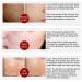 LANBENA Pore Skin Care Serum Facial Essence Minimize Enlarged Pores for Tightening Pores Shrinking Pores + Relieving Dryness + Oil Control Firming + Moisturizing (New Packing) - Buy Online on GoSupps.com