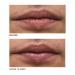 Algenist GENIUS Liquid Collagen Lip Treatment - Vegan, Non-Comedogenic & Hypoallergenic Skincare (15ml) - Buy Online on GoSupps.com