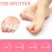 Toe Separator Bunion Corrector for Women Men - Toe Straightener with 2 Loops - Restore Toes Shape - 2 Pairs White - Buy Online on GoSupps.com