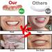 Buy Batlam False Teeth - Comfortable Upper Jaw Veneers for Men & Women | Bright White Dental Replacement for a Confident Smile - Buy Online on GoSupps.com