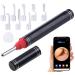 Newgen Medicals Earrkamera: WLAN ear cleaner with full HD camera app live view & 8 essays (camera ear ear cleaner with camera health)