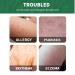 Chinese Herbal Psoriasis Cream - Natural Skin Ointment for Psoriasis Relief - Buy Online on GoSupps.com