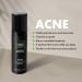 Tiege Hanley ACNE Cream for Men | Salicylic Acid 1.6% | Visibly Reduce Acne & Control Breakouts | 0.85 oz - Buy Online on GoSupps.com