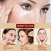Chalazion Eye Treatment & Blepharitis Relief - 30ml Under Eye Serum for Dark Circles Puffiness & Moisturizing Eyelids - Buy Online on GoSupps.com