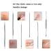 FIXBODY Blackhead & Splinter Remover Tools - Stainless Steel 14 Piece Set - Professional Kit for Pimples, Whiteheads, Acne, Ingrown Hairs and Facial Impurities - Buy Online on GoSupps.com