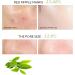 Calming Serum with Green Tea and Hyaluronic Acid Serum Hydrating Face Serum for Sensitive Skin Smooth Glowing Anti-Aging Face Serum - Buy Online on GoSupps.com