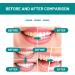 Furzero Smartsmile Mouthwash - Total Care for Fresh Breath & Oral Health - 60ml (2PC) - Buy Online on GoSupps.com