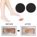 60pcs Foot File Replacement Sandpaper Discs for Electric Callus Remover - Smooth Feet & Easy Care - Buy Online on GoSupps.com