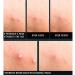 Pyunkang Yul Acne Spot Patch Super Thin - 1 Sheet (15 patches) - Buy Online on GoSupps.com
