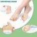 LUCKYNA Women's Orthopedic Bunion Corrector & Toe Separator - Pain Relief, Non-Surgical Hallux Valgus Correction, Hammer Toe Straightener - 1 Pair (Complexion) - Buy Online on GoSupps.com