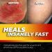 CrashPads Adhesive Bandages for Road Rash & Burns - 14pcs Assorted Sizes in Raspberries (Roadrash Dressing) - Buy Online on GoSupps.com