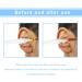 23Pcs Q-Grips Spiral Ear Wax Removal Tool Kit - Earwax Remover, Syringe, Silicone Cleaner, Bamboo Pick - Ear Irrigation Cleaning Set - Buy Online on GoSupps.com