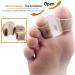Soft and Skin-Friendly Toe Straightener with Double Orifice Design - Relieve Foot Pain, Overlapping Hallux Valgus, Hammer Toe - Medium 1 Pair - Buy Online on GoSupps.com