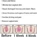 AnnieCare Anti-Itch Detox Slimming Firming Repair Capsules - 4 Boxes, 28 pcs - Tightens, Removes Odor, Reverts to Tight & Tender State - Buy Online on GoSupps.com