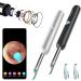 BEBIRD R1 Ear Wax Removal Tool Camera Endoscope - 1080P HD Wireless Ear Cleaner with 6 LED Lights for iPhone, iPad, Android - Kids, Adults & Pets (Black) - Buy Online on GoSupps.com