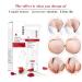 Effective Stretch Marks Removal Cream for Women Targets Pregnancy & Acne Marks Moisturizes & Firms Skin - Buy Online on GoSupps.com