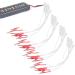 Buy 20 Pieces Electrode Cable Clips for TENS Devices | International Shipping Available - Buy Online on GoSupps.com