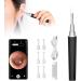 1080p HD Digital Otoscope Camera with Light - Ear Wax Removal WiFi Endoscope for iPhone iPad & Android - IP67 Waterproof 3.9mm Ultra-Thin Design (Black) - Buy Online on GoSupps.com
